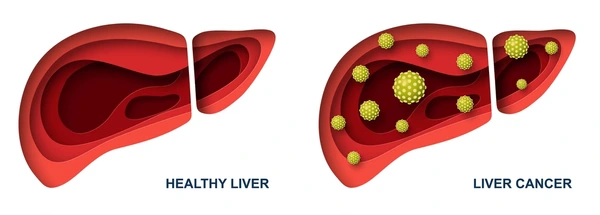 liver-cancer-healthy-organ-vector