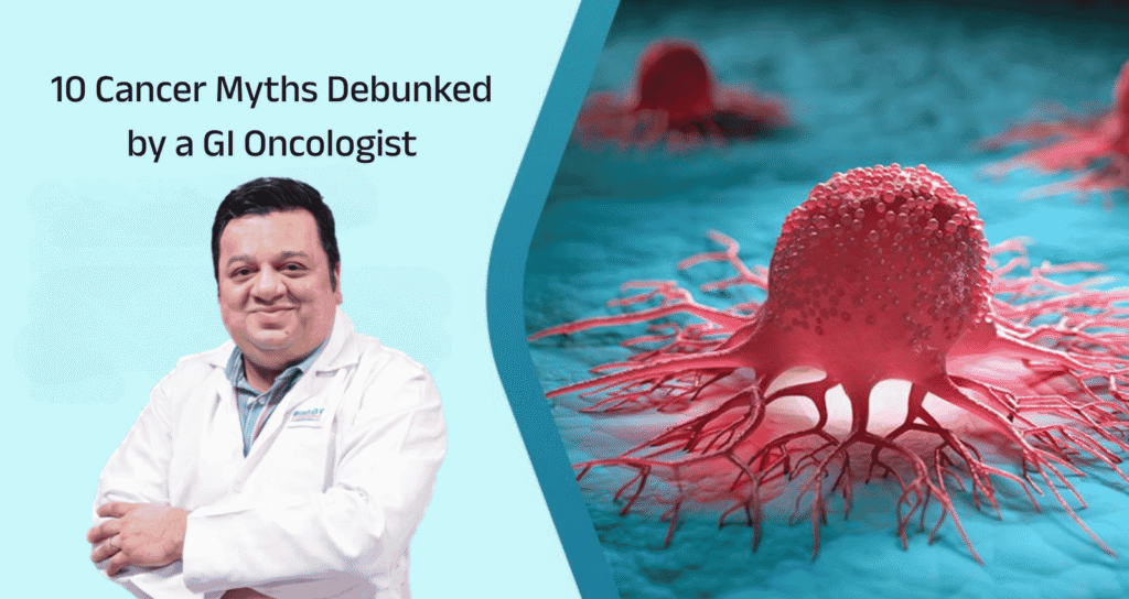 10 Cancer Myths Debunked by a GI Oncologist