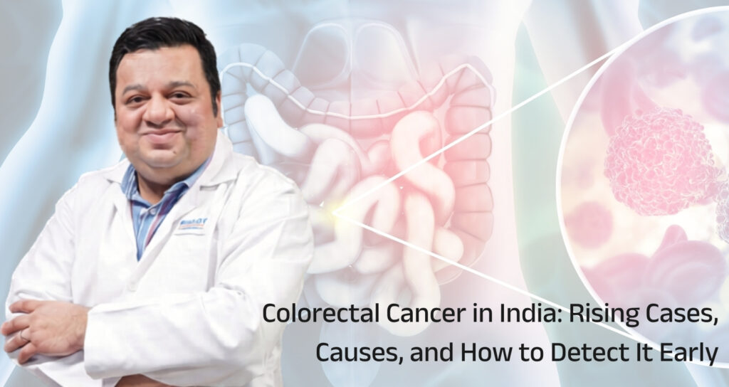 Colorectal Cancer in India: Rising Cases, Causes, and How to Detect It Early