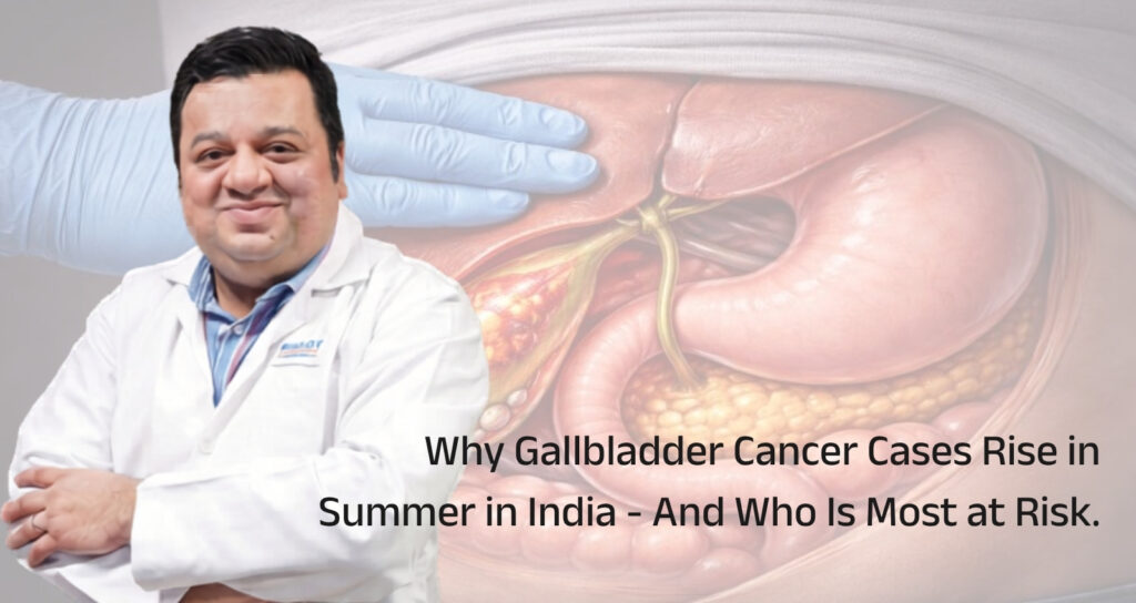 Why Gallbladder Cancer Cases Rise in Summer in India – And Who Is Most at Risk.