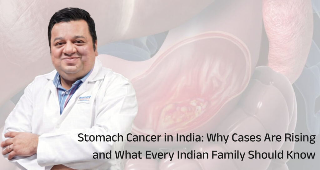 Stomach Cancer in India: Why Cases Are Rising and What Every Indian Family Should Know
