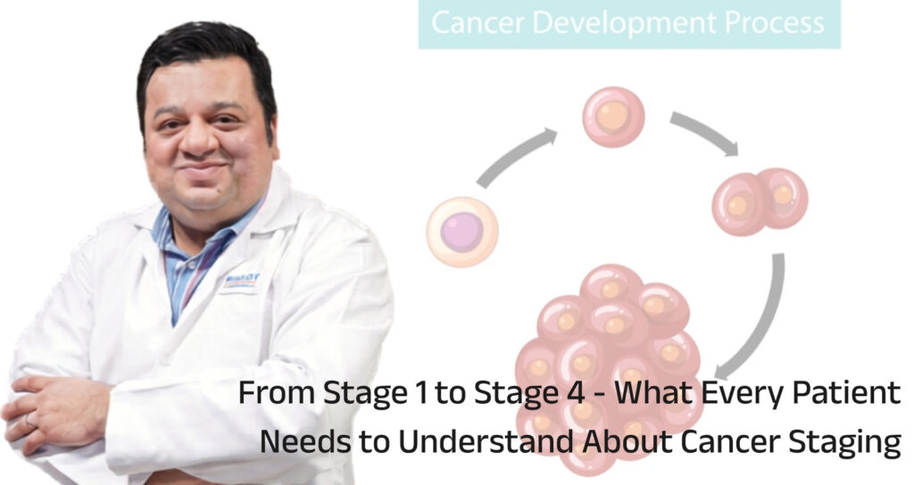 From Stage 1 to Stage 4 – What Every Patient Needs to Understand About Cancer Staging